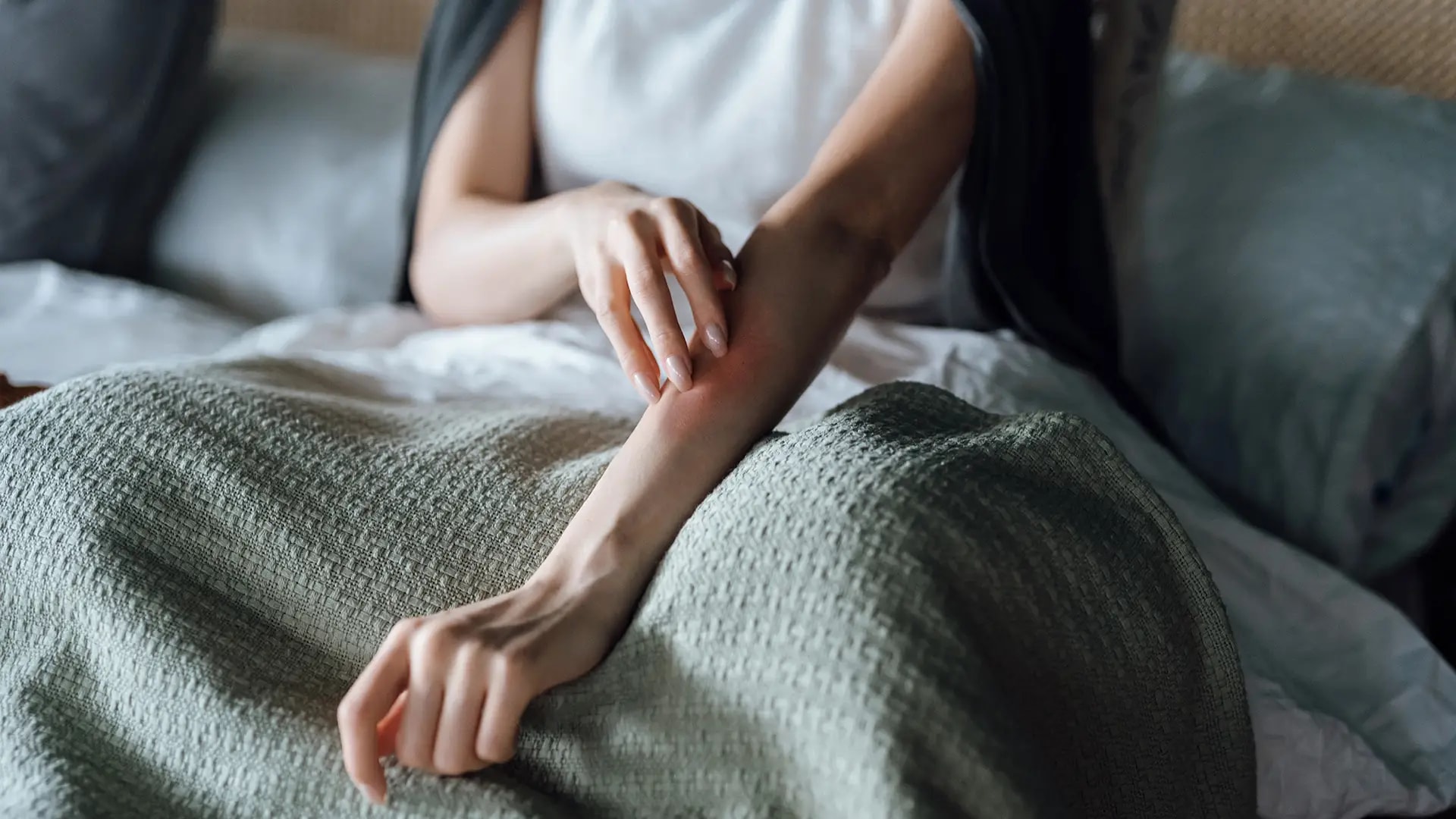 Top 10 ways to treat eczema