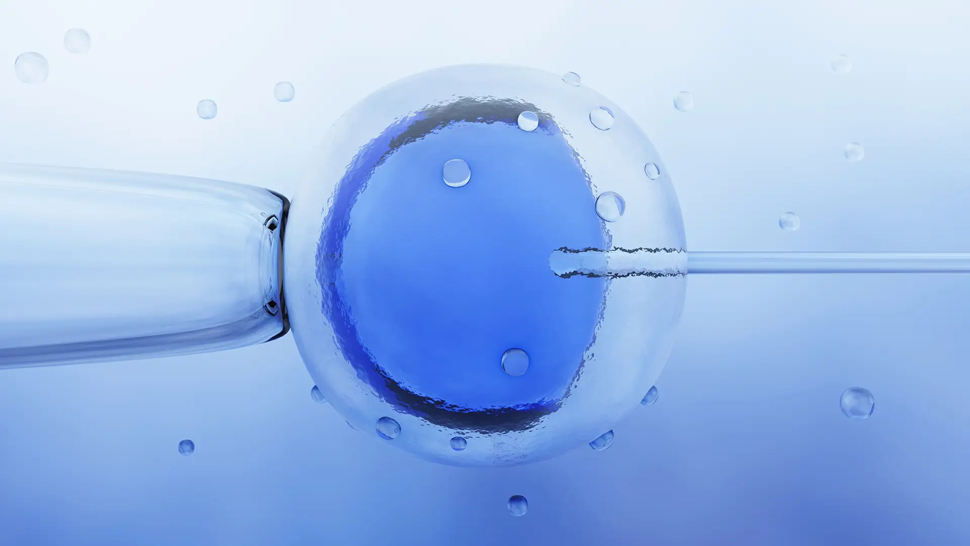 In Vitro Fertilisation (IVF) - Step by Step